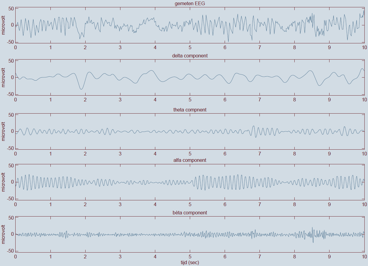 separation of EEG signal in the frequency ranges